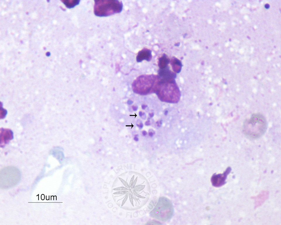 Diversas amastigotas são observadas no interior de um macrófago (setas).