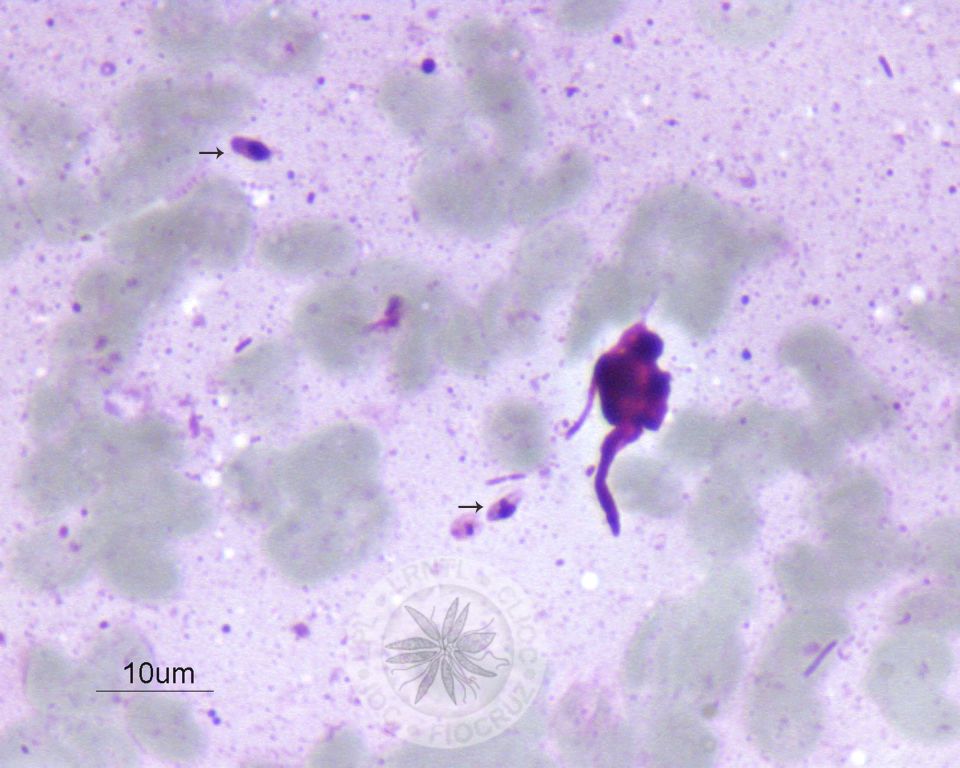 Duas amastigotas são vistas nesta imagem (setas).
				[Notar a presença de membrana celular, núcleo e cinetoplasto nas amastigotas].