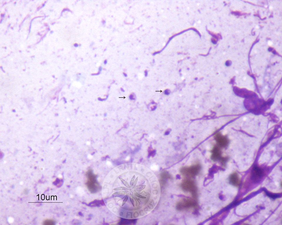 Diversas amastigotas são observadas nesta imagem (setas). 
				[Notar a presença de membrana celular, núcleo e cinetoplasto nas amastigotas].