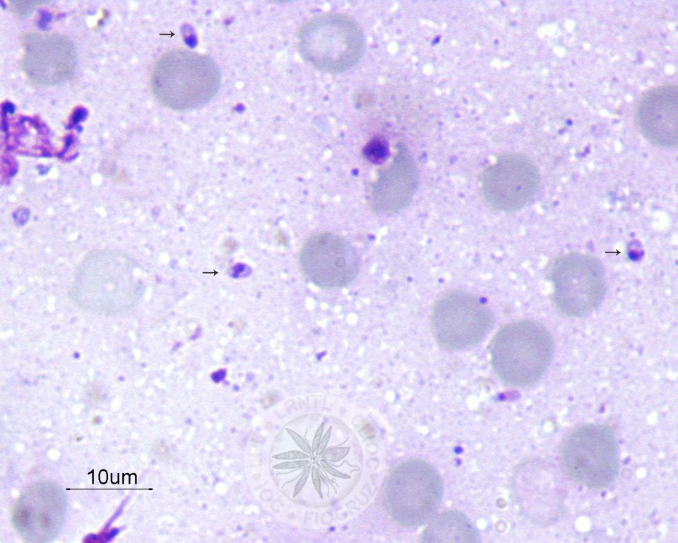 Três amastigotas são observadas nesta imagem (setas). 
				[Notar a presença de membrana celular, núcleo e cinetoplasto nas amastigotas].