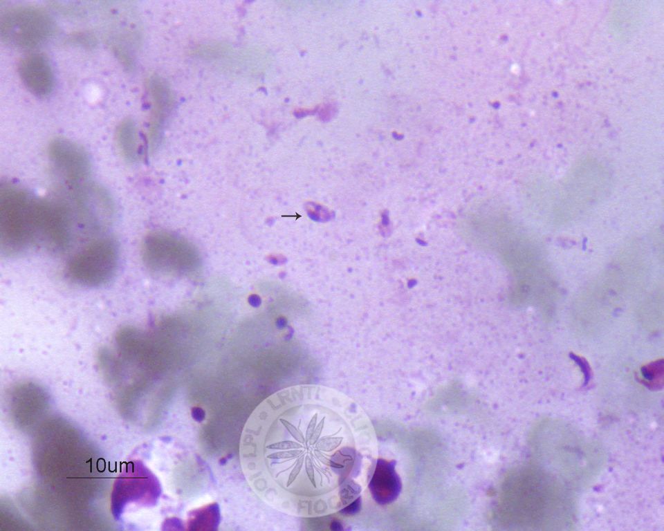 Uma amastigota é vista nesta imagem (seta). 
				[Notar a presença de membrana celular, núcleo e cinetoplasto nas amastigotas].